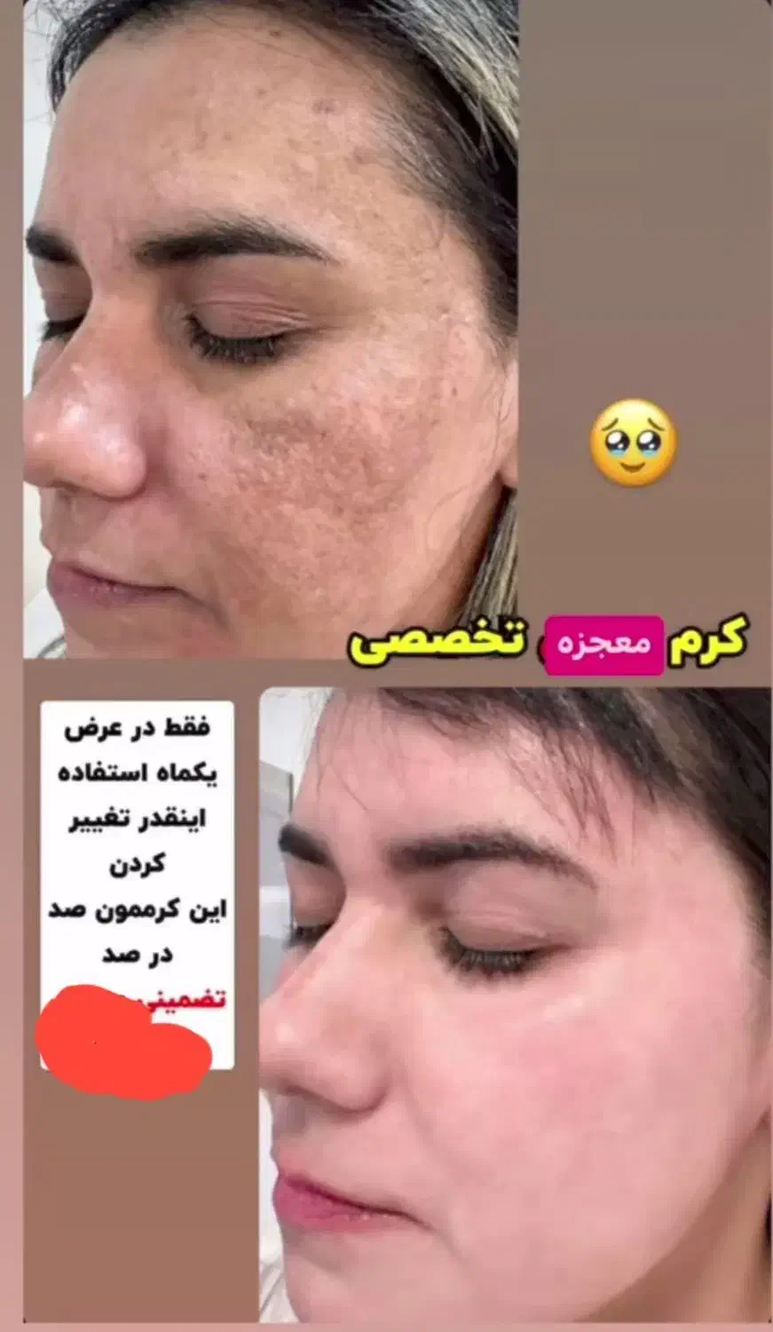 کرم معجزه اصلی|آرایشی، بهداشتی، درمانی|قرچک, شهرک گلها|دیوار