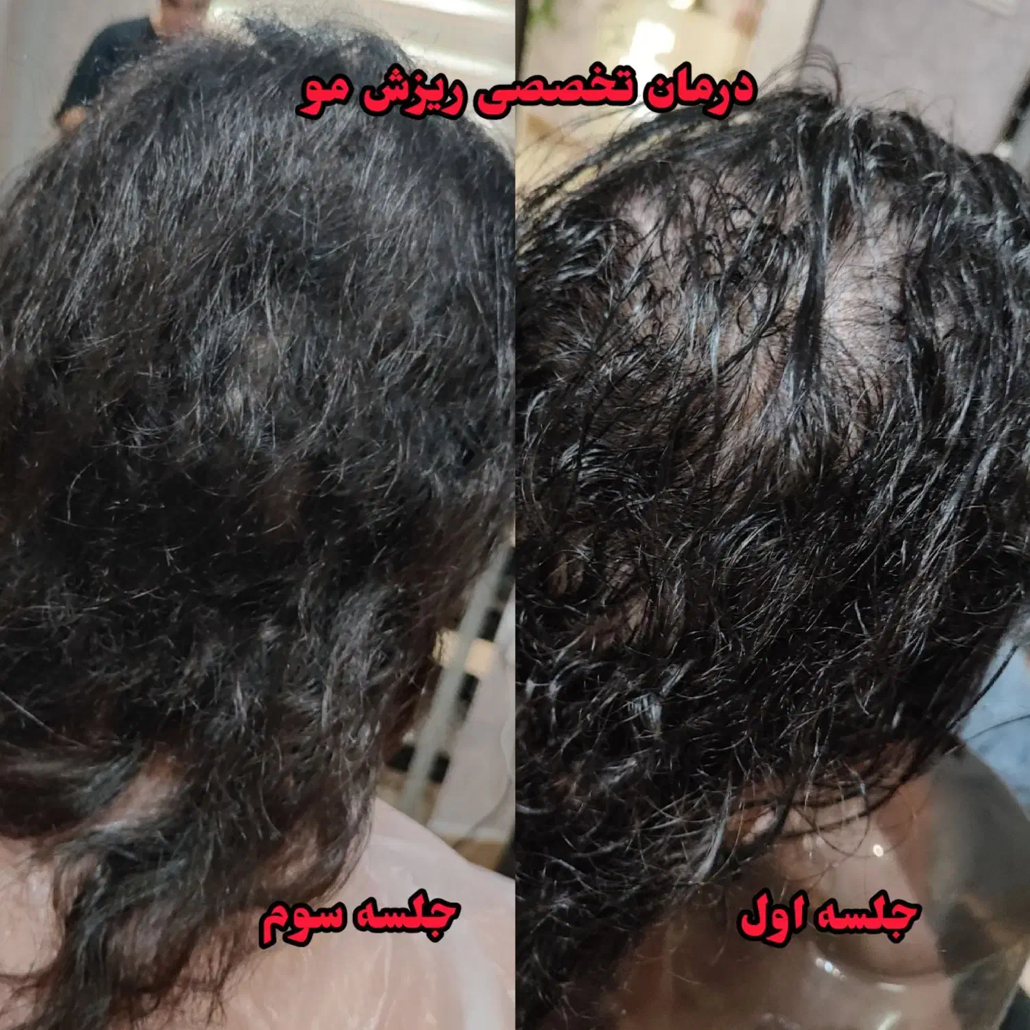 اسکراب اسکالپ|خدمات آرایشگری و زیبایی|رشت, رشتیان|دیوار