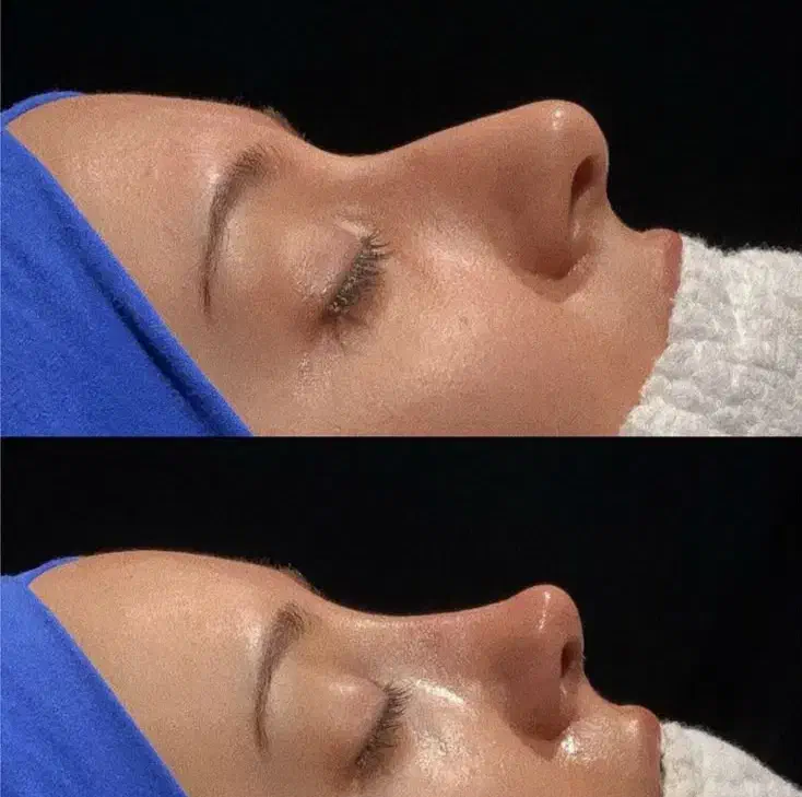 عمل بینی با قیمت جشنواره و نصف قیمت در تهران|خدمات آرایشگری و زیبایی|کرمان, |دیوار