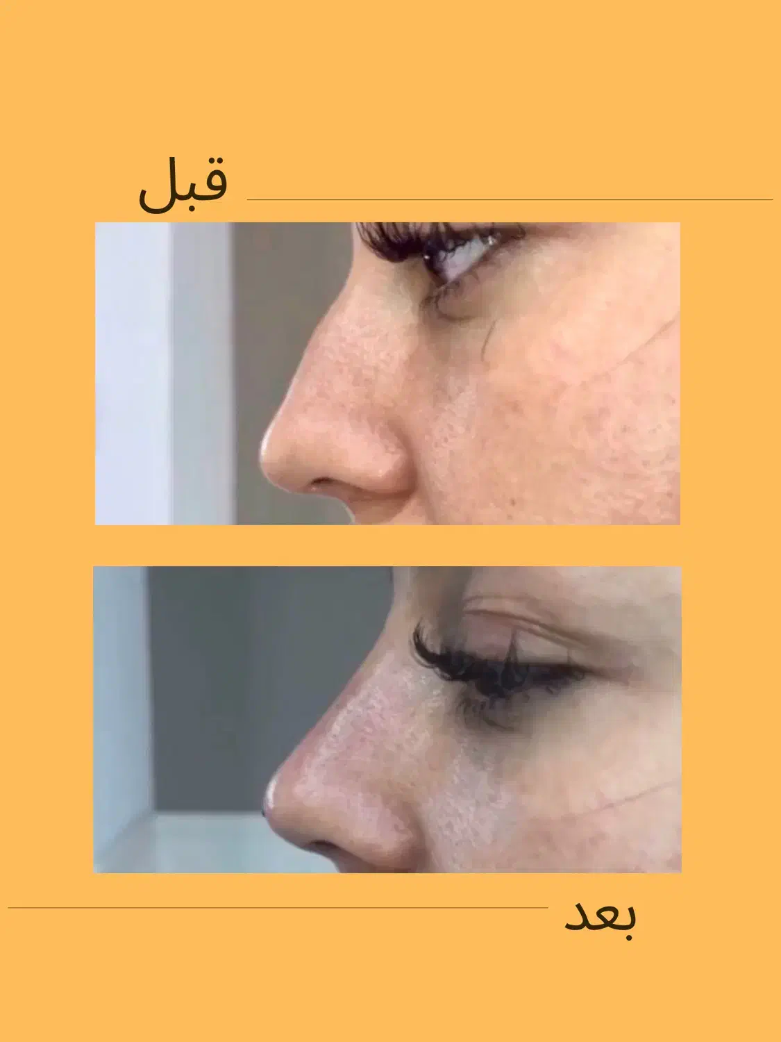 خدمات زیبایی در کلینیک ماهورا|خدمات آرایشگری و زیبایی|بندرعباس, |دیوار