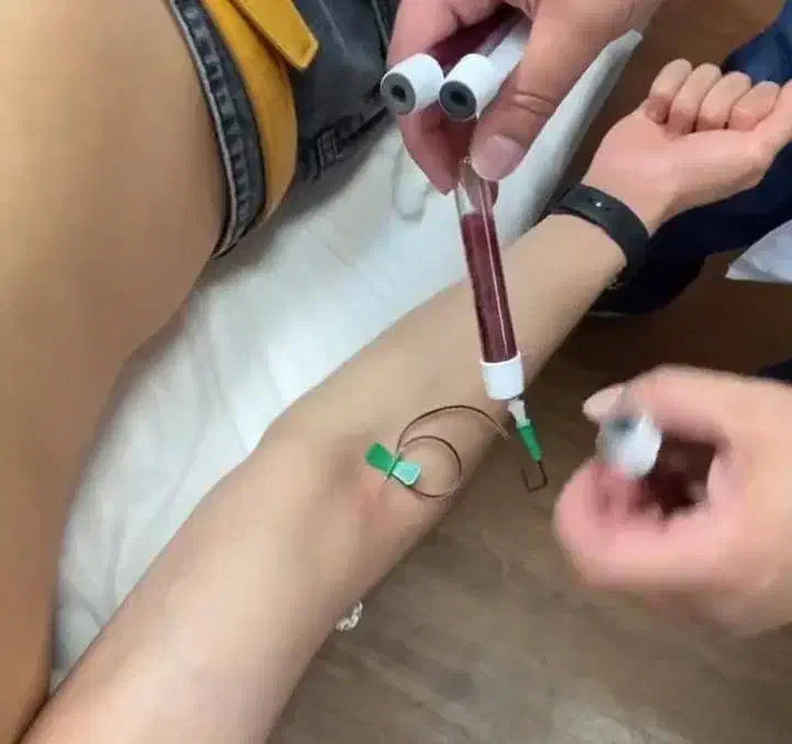 رشد سریع مو و prpصورت و دست فقط با ۱میلیون|خدمات آرایشگری و زیبایی|سهند, |دیوار