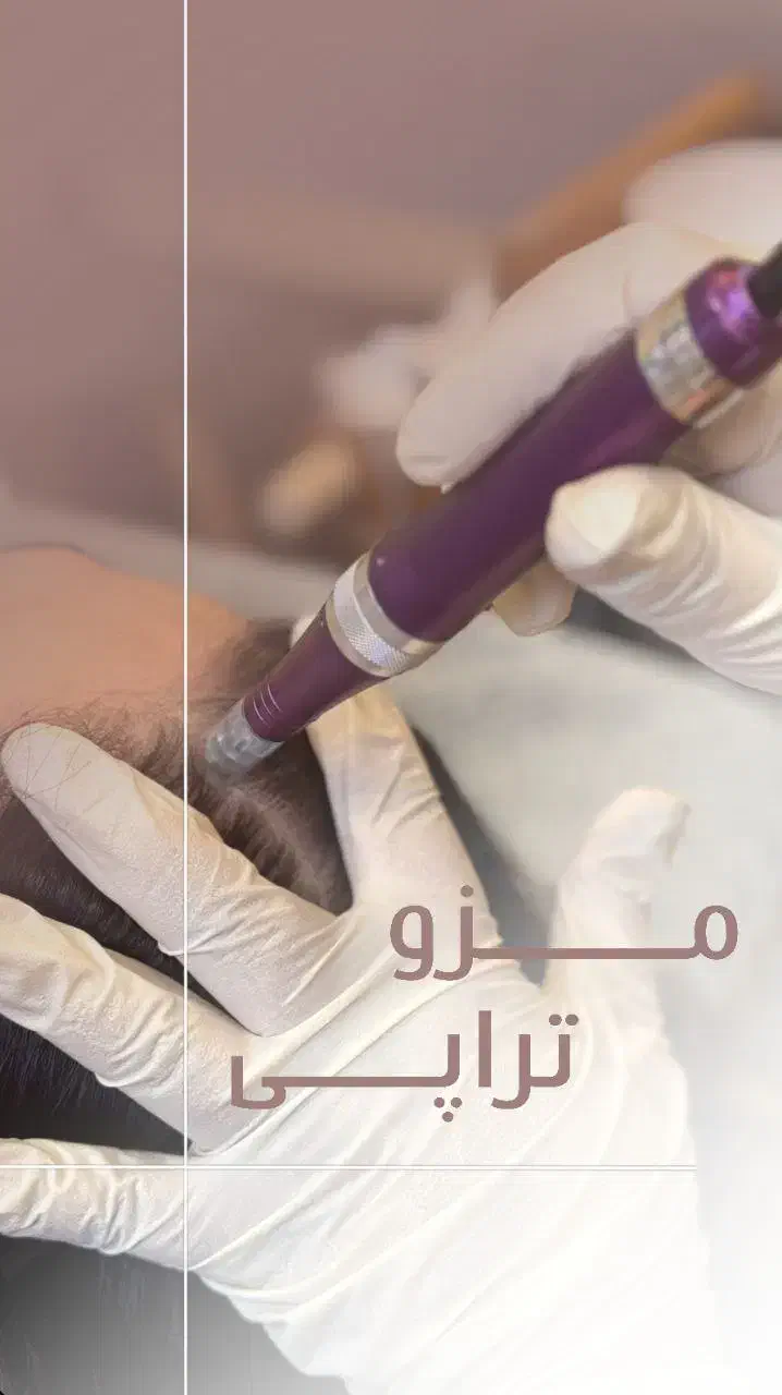 آموزش کامل  اسکراب اسکالپ سر|خدمات آموزشی|مشهد, شریف|دیوار