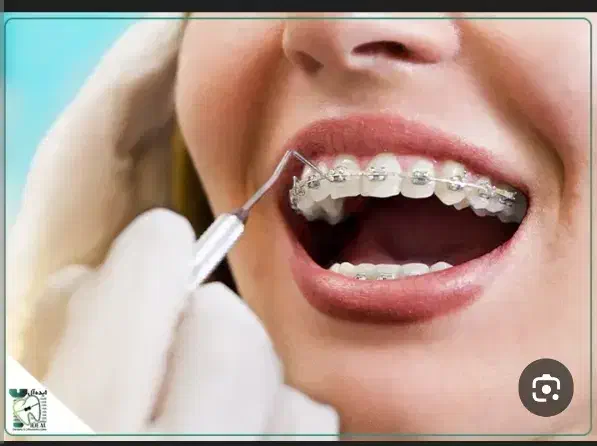 راهنمایی ارتودنسی|فعالیت داوطلبانه تحقیقاتی|کرمانشاه, |دیوار