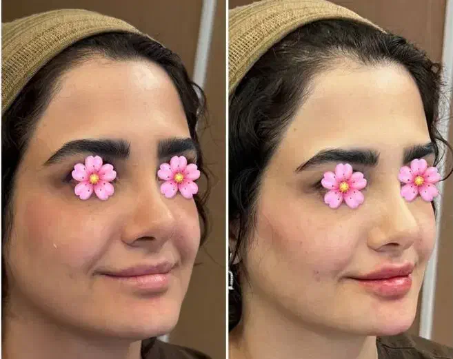 شما برندترین کلینیک زیبایی درایران را پیدا کردید|خدمات آرایشگری و زیبایی|کاشان, میدان کهنه|دیوار