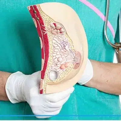 راهنمایی برای کیست سینه|فعالیت داوطلبانه|اهر, |دیوار