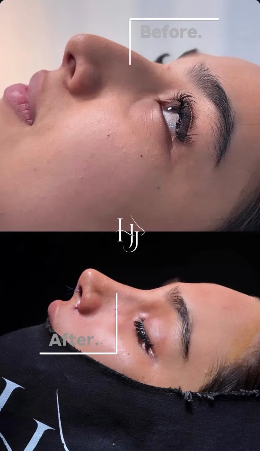 جراحی بینی توسط متخصص گوش و حلق بینی پرداخت اقساطی|خدمات زیبایی و سلامت|مشهد, احمدآباد|دیوار