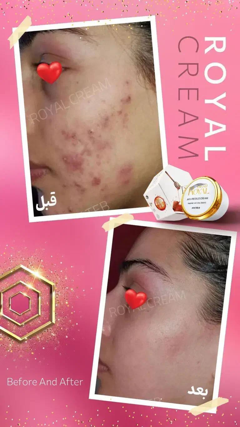 ژل کرم رویال|آرایشی، بهداشتی، درمانی|نورآباد ممسنی, |دیوار