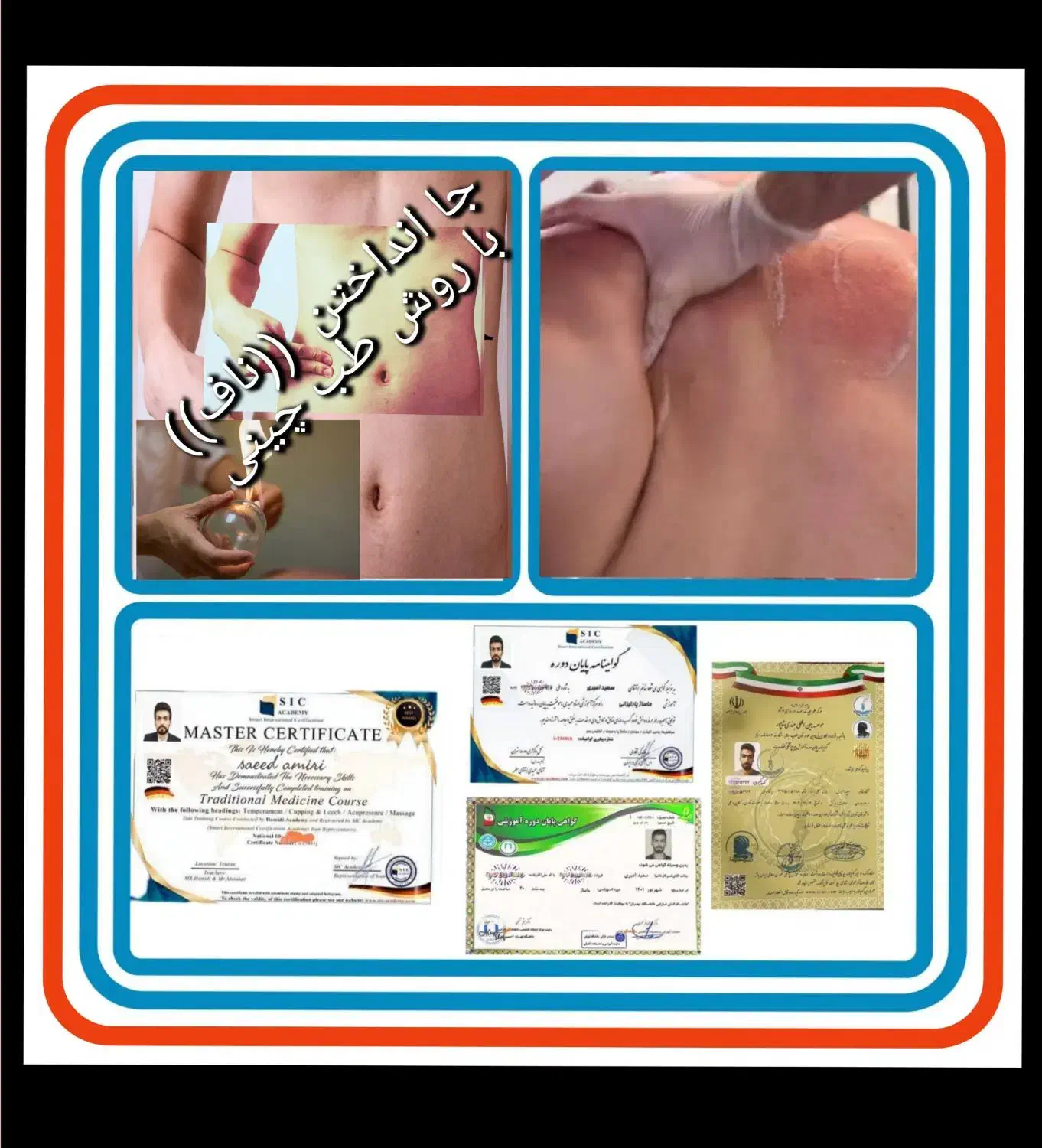 حجامت/بادکش/زالو/ناف گیر/ماسـاژدرمنــزل شـما|خدمات آرایشگری و زیبایی|کرمانشاه, |دیوار