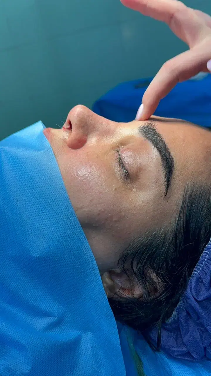 عمل جراحی زیبایی بینی/لیفت/ابدو/لیپو/بلفارو|خدمات زیبایی و سلامت|تهران, نارمک|دیوار