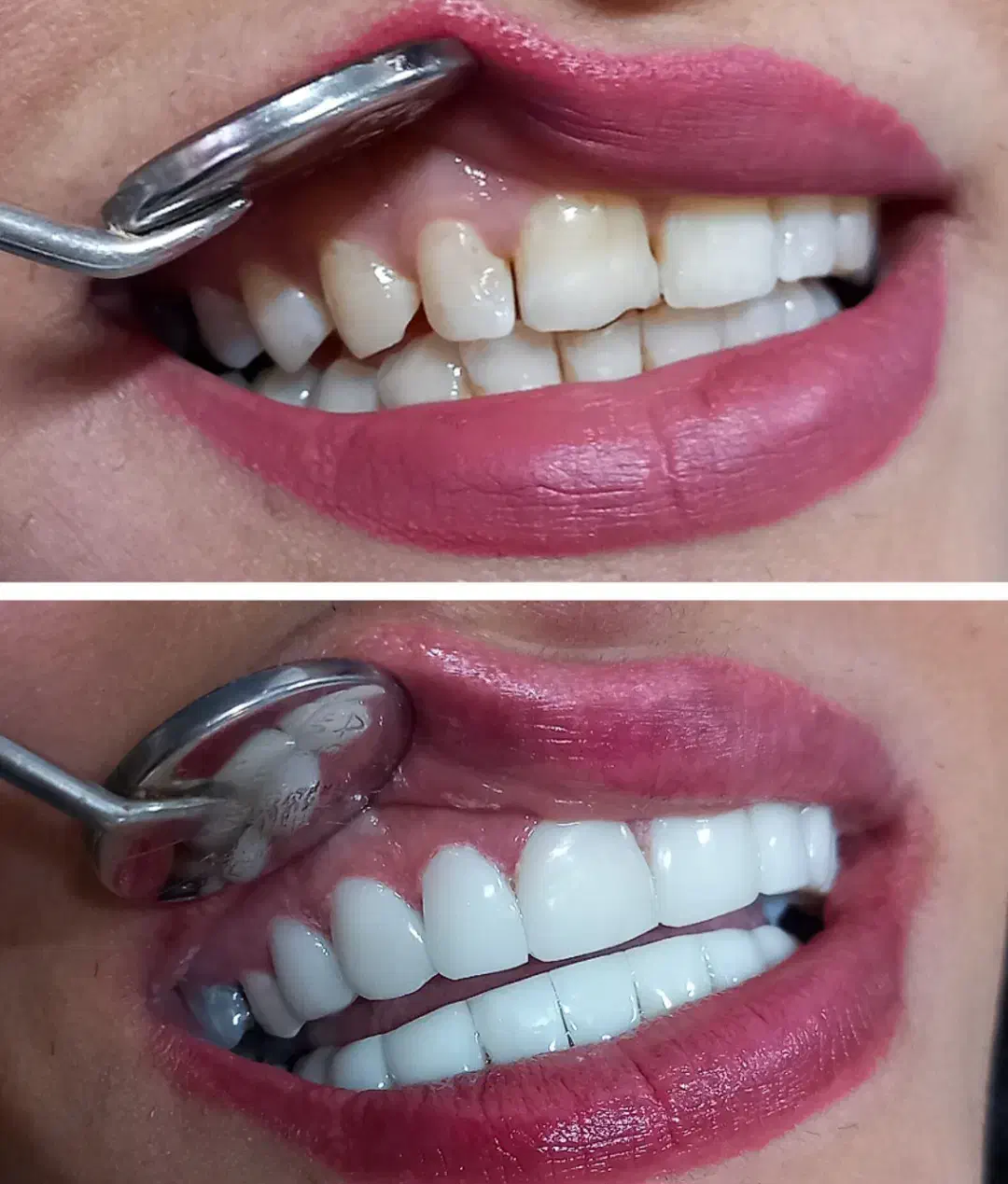 کامپوزیت زیبایی جشنواره ی تخفیفی یلدا|خدمات آرایشگری و زیبایی|کوهدشت, |دیوار