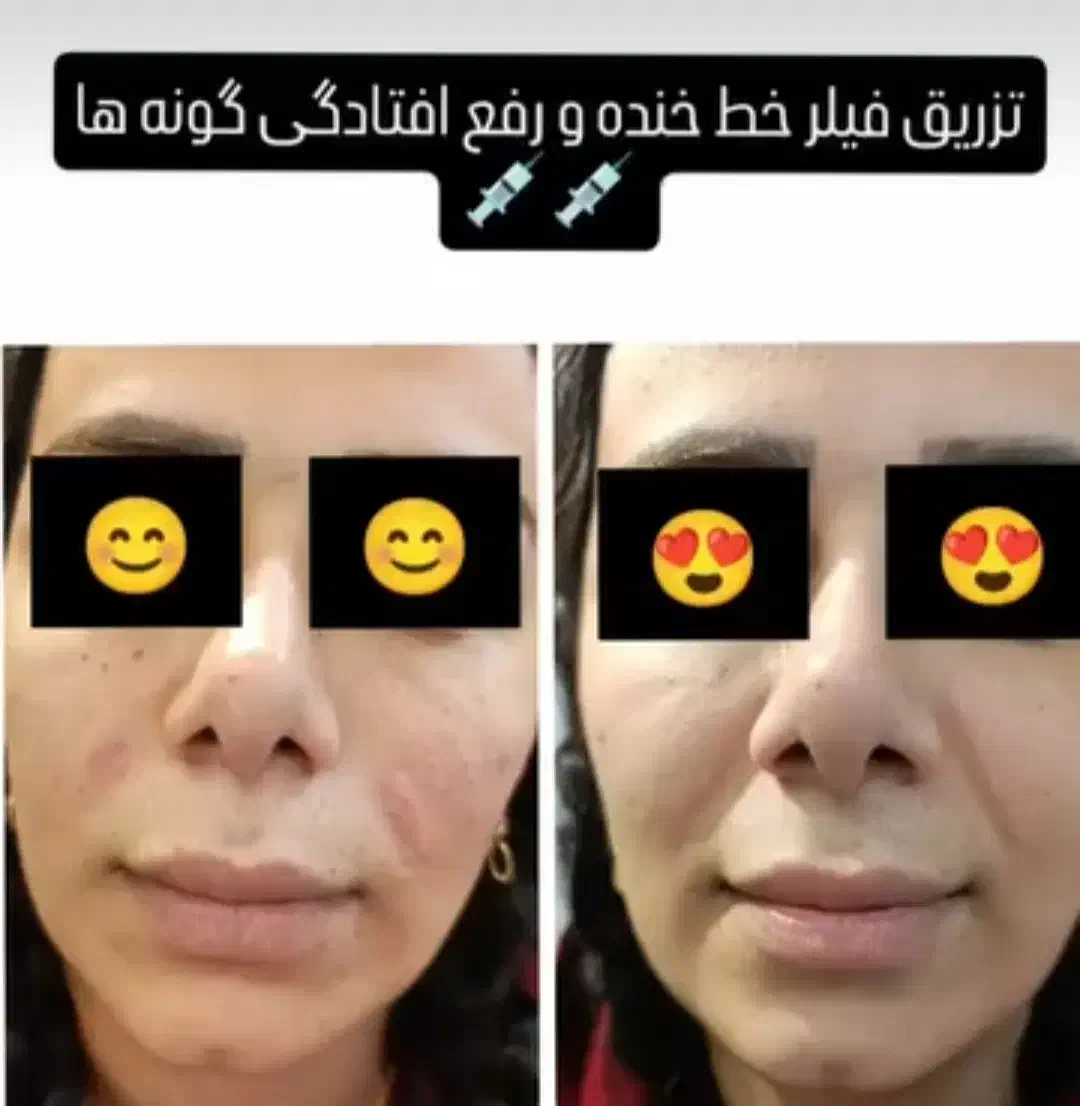 سالن ارایش زیبایی|خدمات آرایشگری و زیبایی|فولادشهر, مسکن مهر فولادشهر|دیوار
