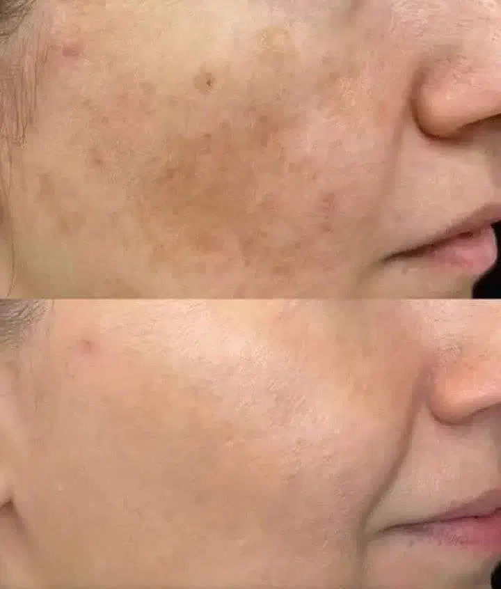 روغن تراپی با درآمد|خدمات آرایشگری و زیبایی|بانه, |دیوار