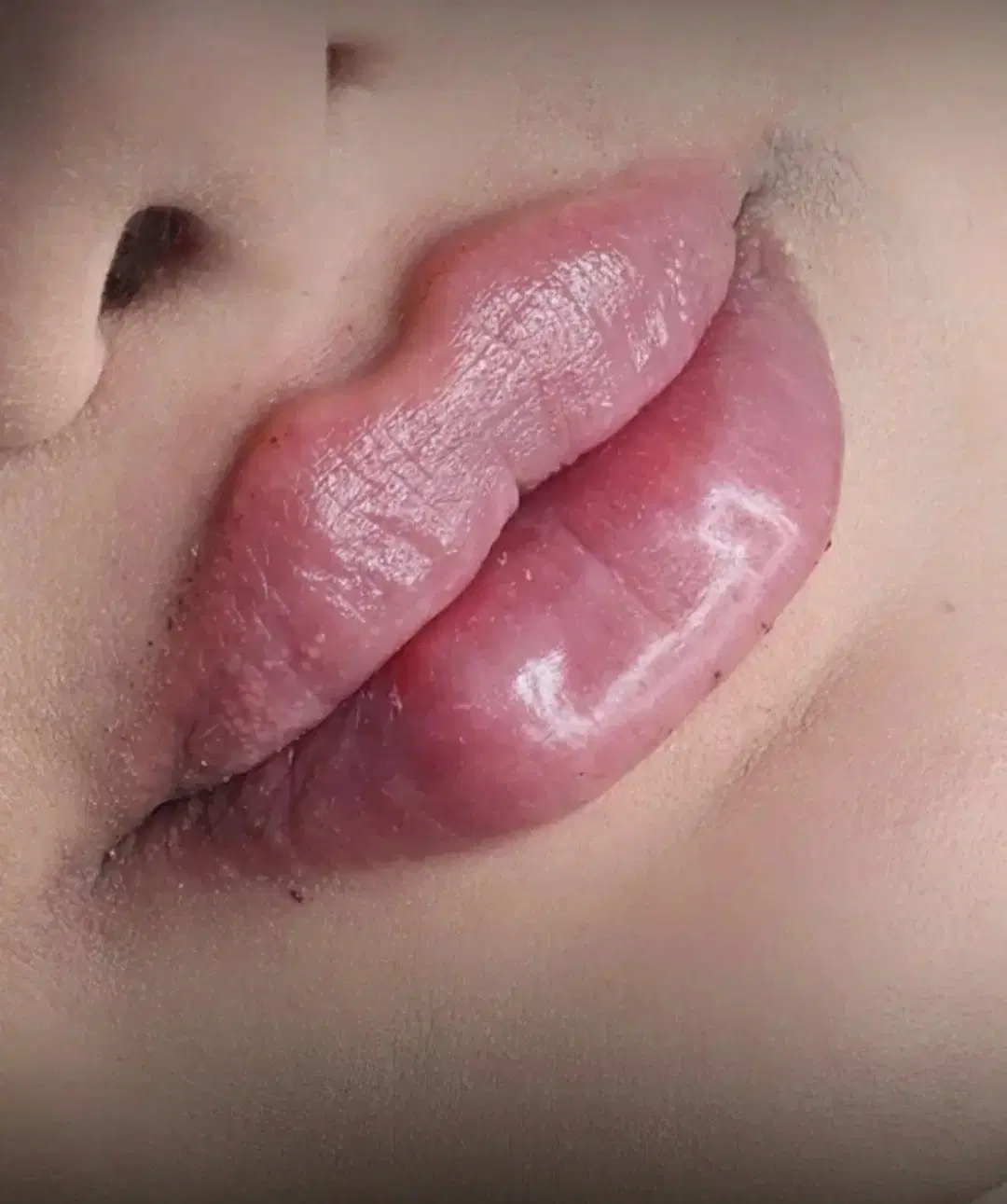 آف ویژه 800 تزریقات وآموزش ژل و بوتاکس پرسینگ|خدمات زیبایی و سلامت|شیراز, لشکری|دیوار