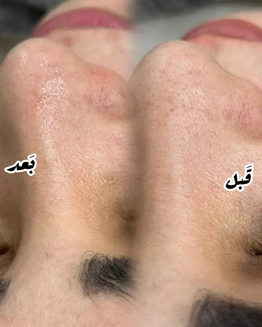 فیشال تخصصی|خدمات آرایشگری و زیبایی|ورامین, ورامین|دیوار