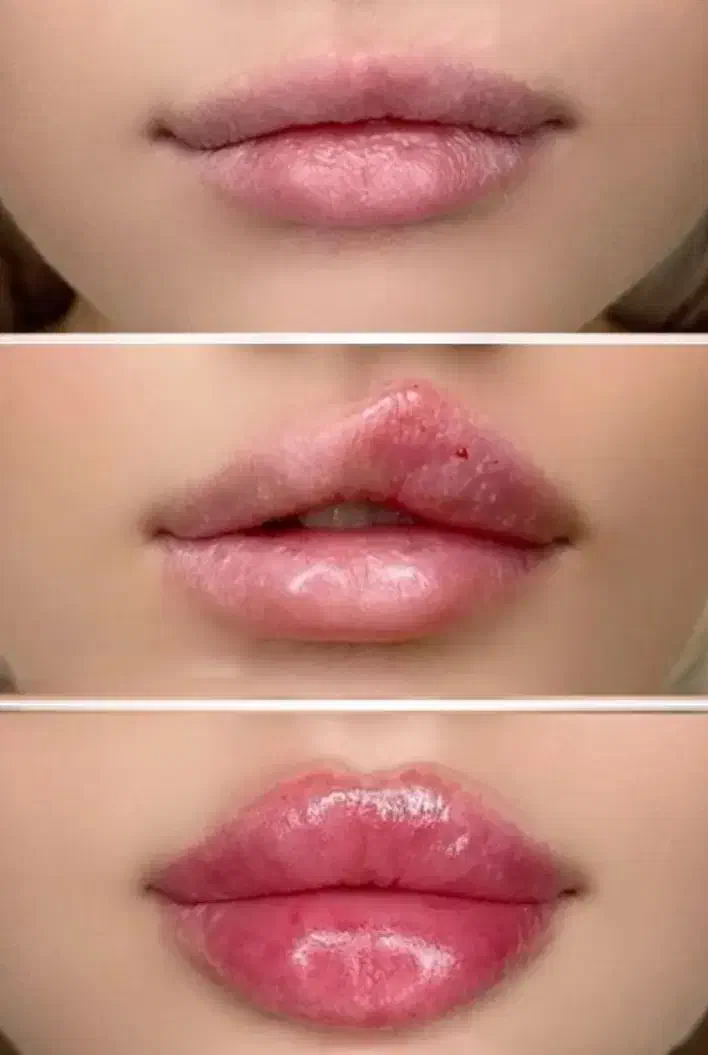 تخفیف ژل و بوتاکس ویژه فقط برای فردا|خدمات آرایشگری و زیبایی|مشهد, شهید معقول|دیوار