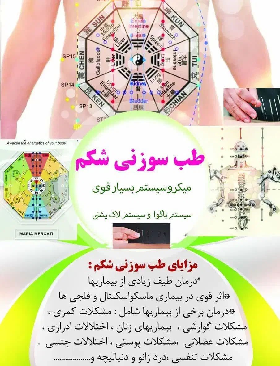 آموزش طب سوزنی شکم|خدمات آموزشی|اراک, |دیوار
