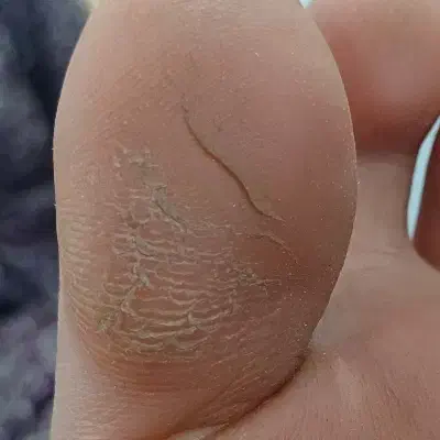 پدیکوروکف سابی پا. پاکسازی دست وپا قوزک ارنج وزانو|خدمات آرایشگری و زیبایی|جیرفت, |دیوار