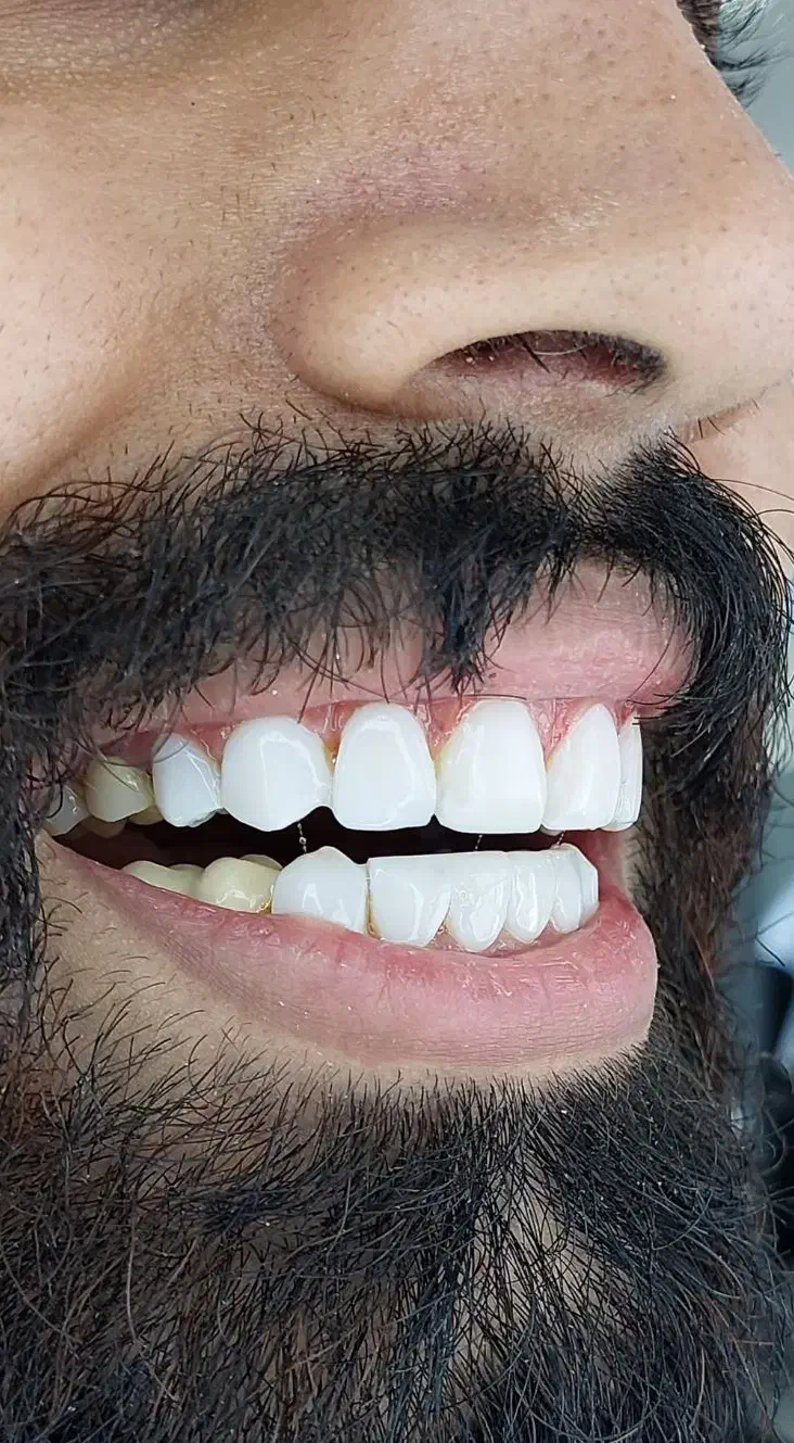 کامپوزیت زیبایی واحدی ۱،۶۰۰|خدمات آرایشگری و زیبایی|گرگان, |دیوار