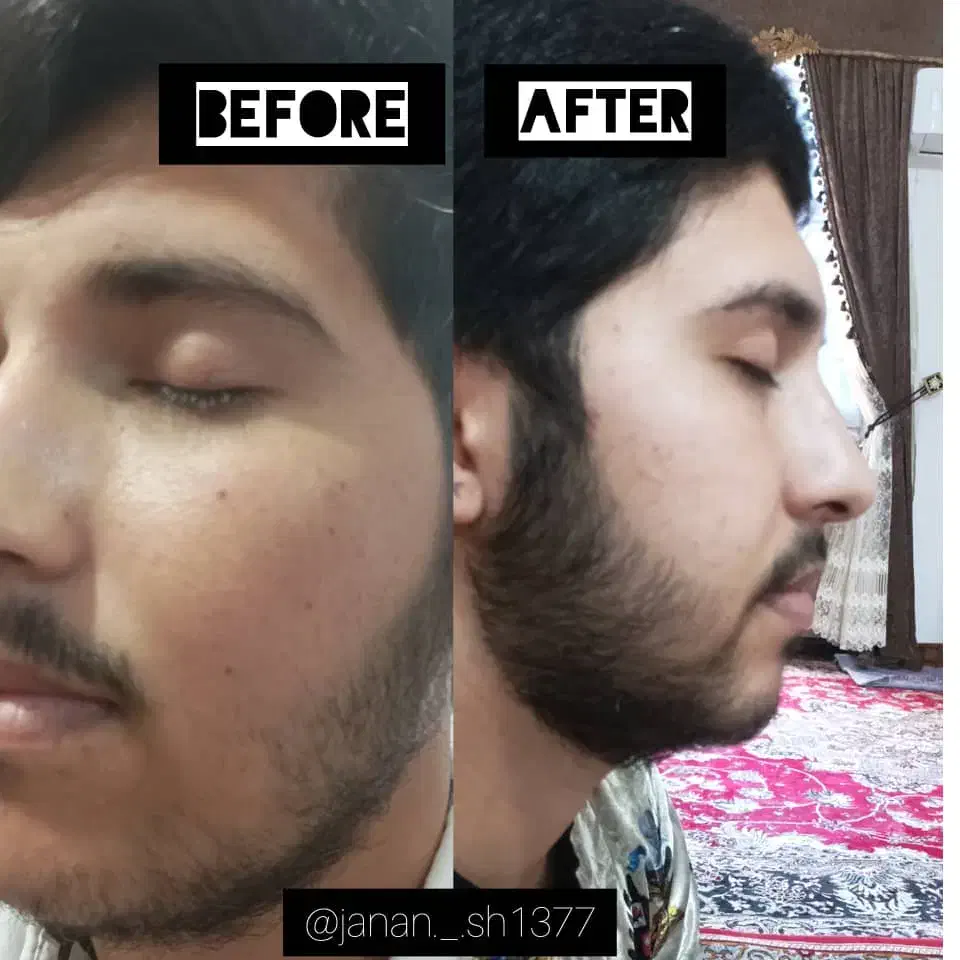 کرم اماراتی اصل، روغن رویش مو و ضد ریزش مو|آرایشی، بهداشتی، درمانی|زهک, |دیوار