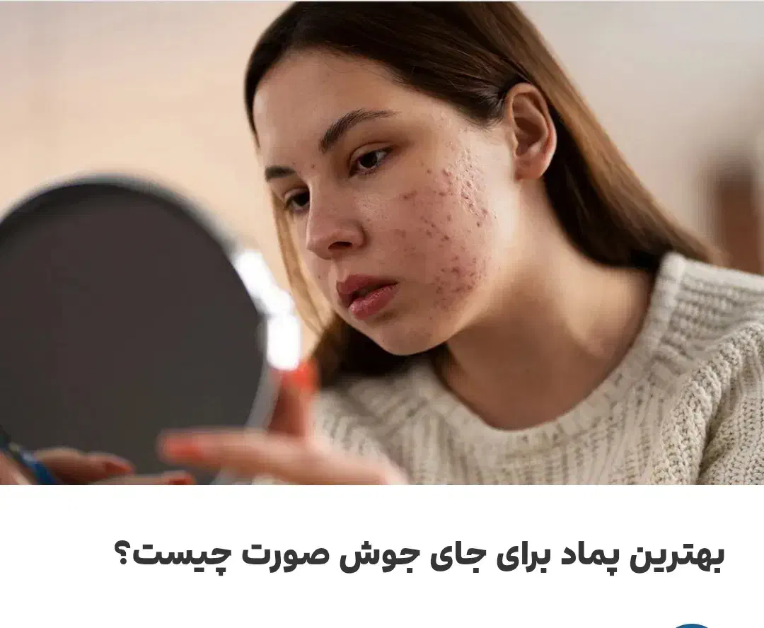 جوش یا لک و جای جوش در صورت و بدن|آرایشی، بهداشتی، درمانی|شیراز, لشکری‎|دیوار