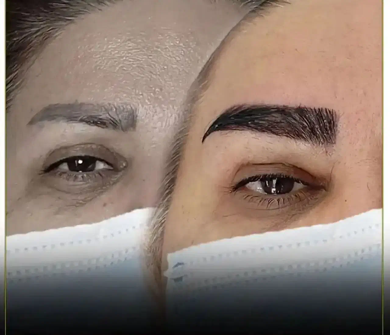 استخدام تکنسین کاشت کار و کات کار|استخدام درمانی، زیبایی، بهداشتی|قم, زنبیل آباد|دیوار