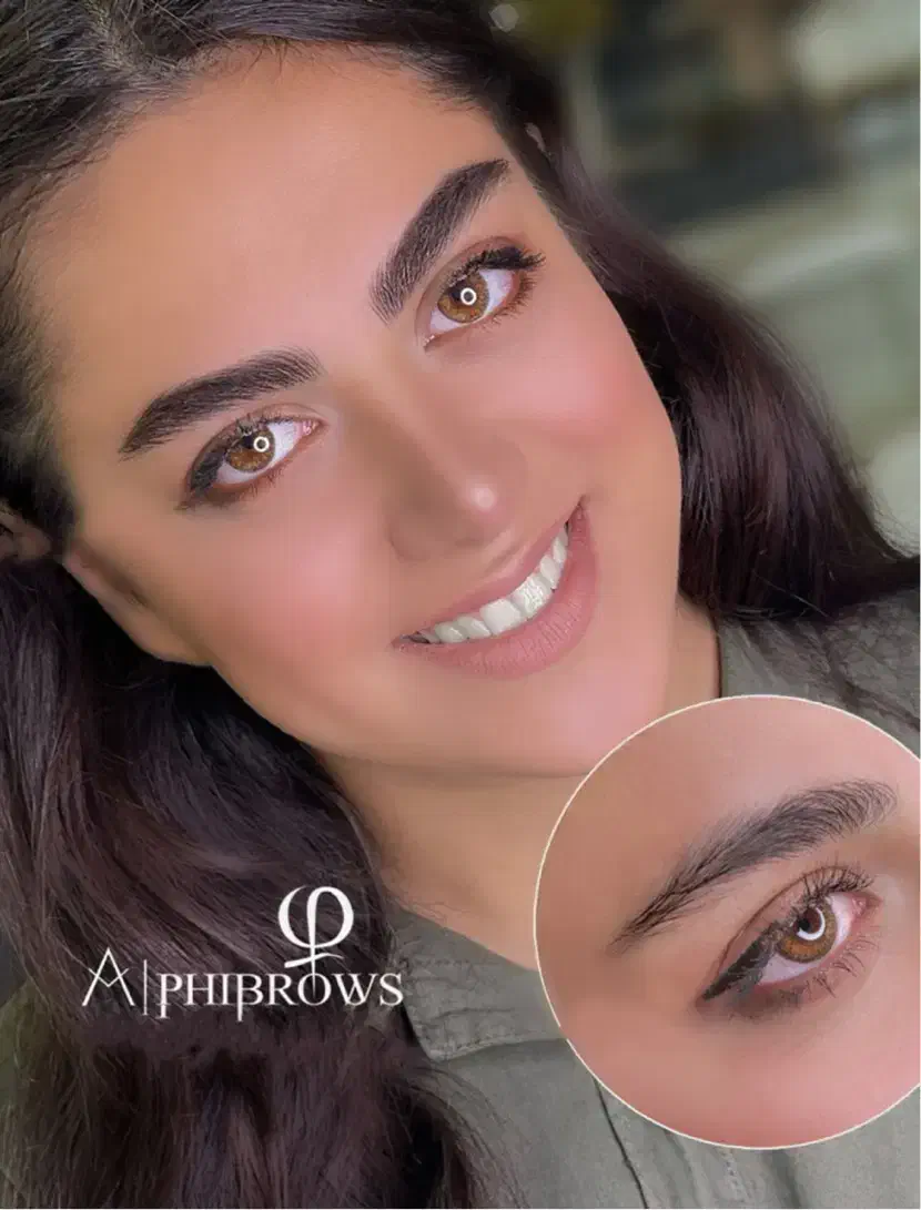 میکروبلیدینگ و فیبروز کرکی و موئی|خدمات آرایشگری و زیبایی|فردیس, فردیس|دیوار