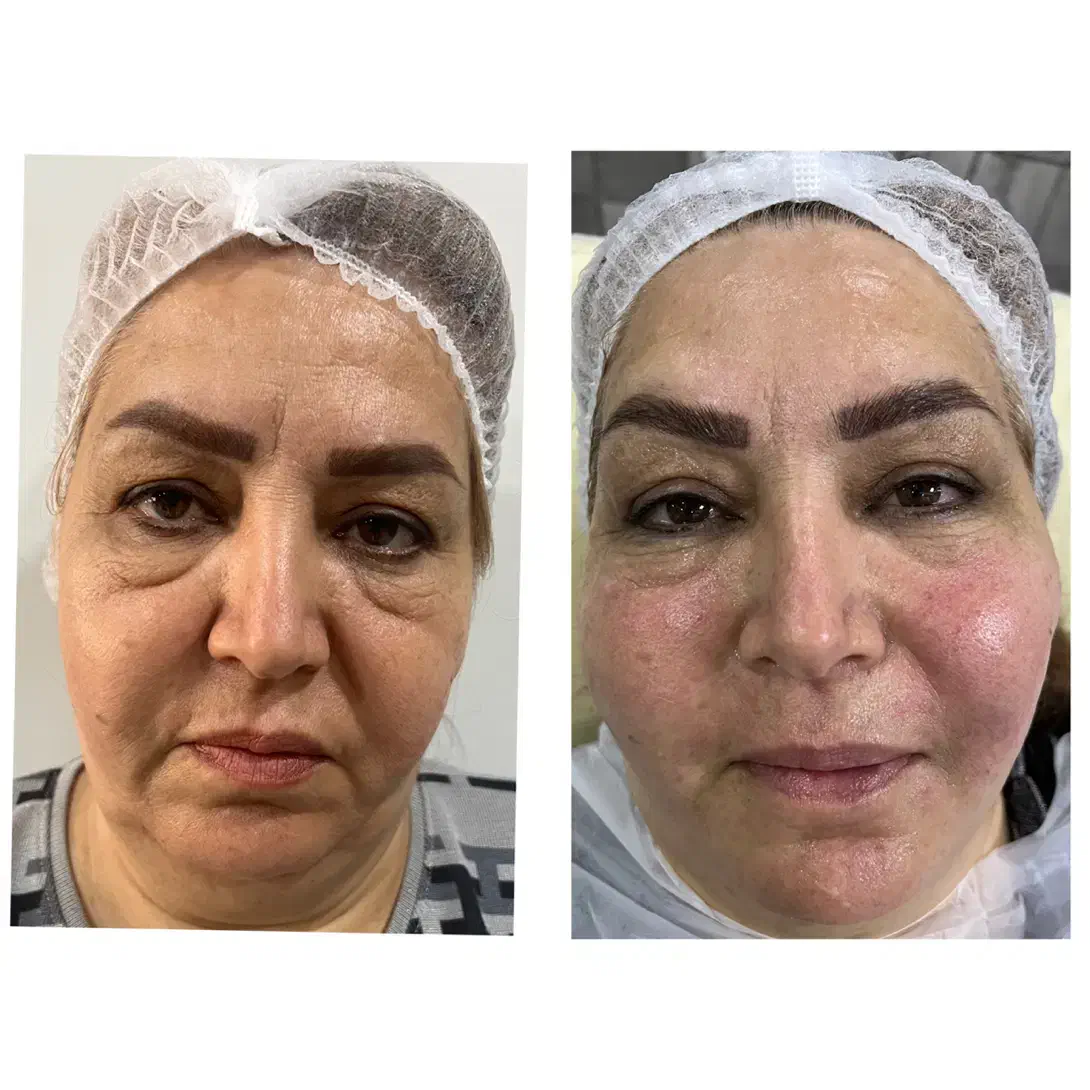 مرکز زیبایی|خدمات آرایشگری و زیبایی|اردبیل, |دیوار