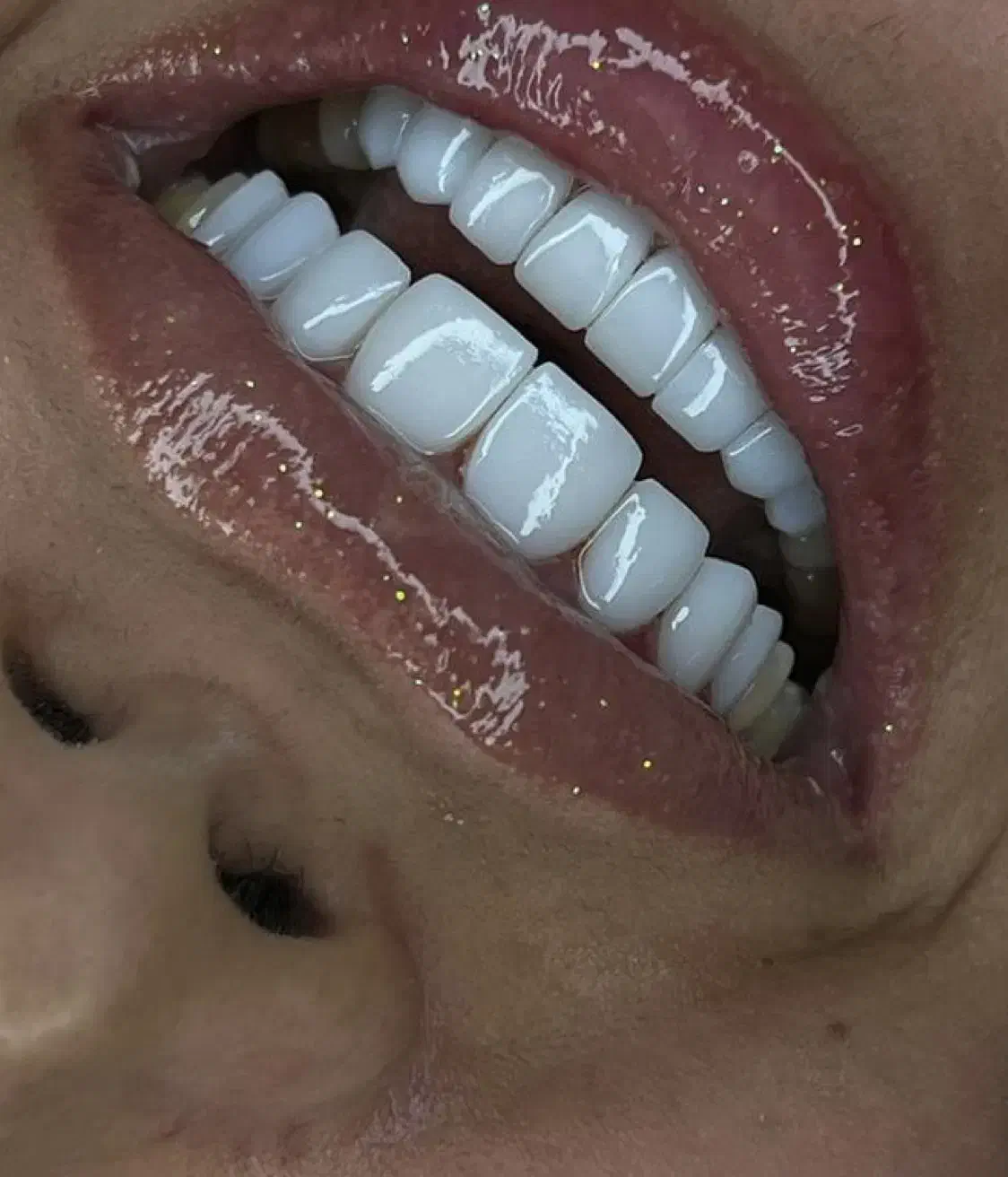 آف ویژه خدمات تخصصی کامپوزیت دندان|خدمات آرایشگری و زیبایی|شاهین‌شهر, فردوسی|دیوار