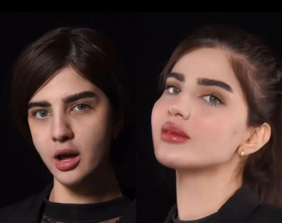 پزشک ژل۷۹۰ بوتاکس۶۰۰آنزیم۷۹۰ مزو۷۹۰مزوژل نخ کلاژن|خدمات زیبایی و سلامت|کرج, گوهردشت|دیوار