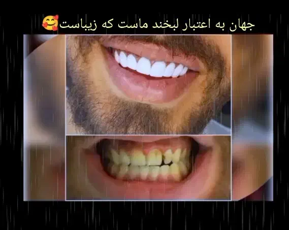 مژده مژده کامپوزیت برای یک ماه  تخفیف ویژه|خدمات آرایشگری و زیبایی|یاسوج, |دیوار