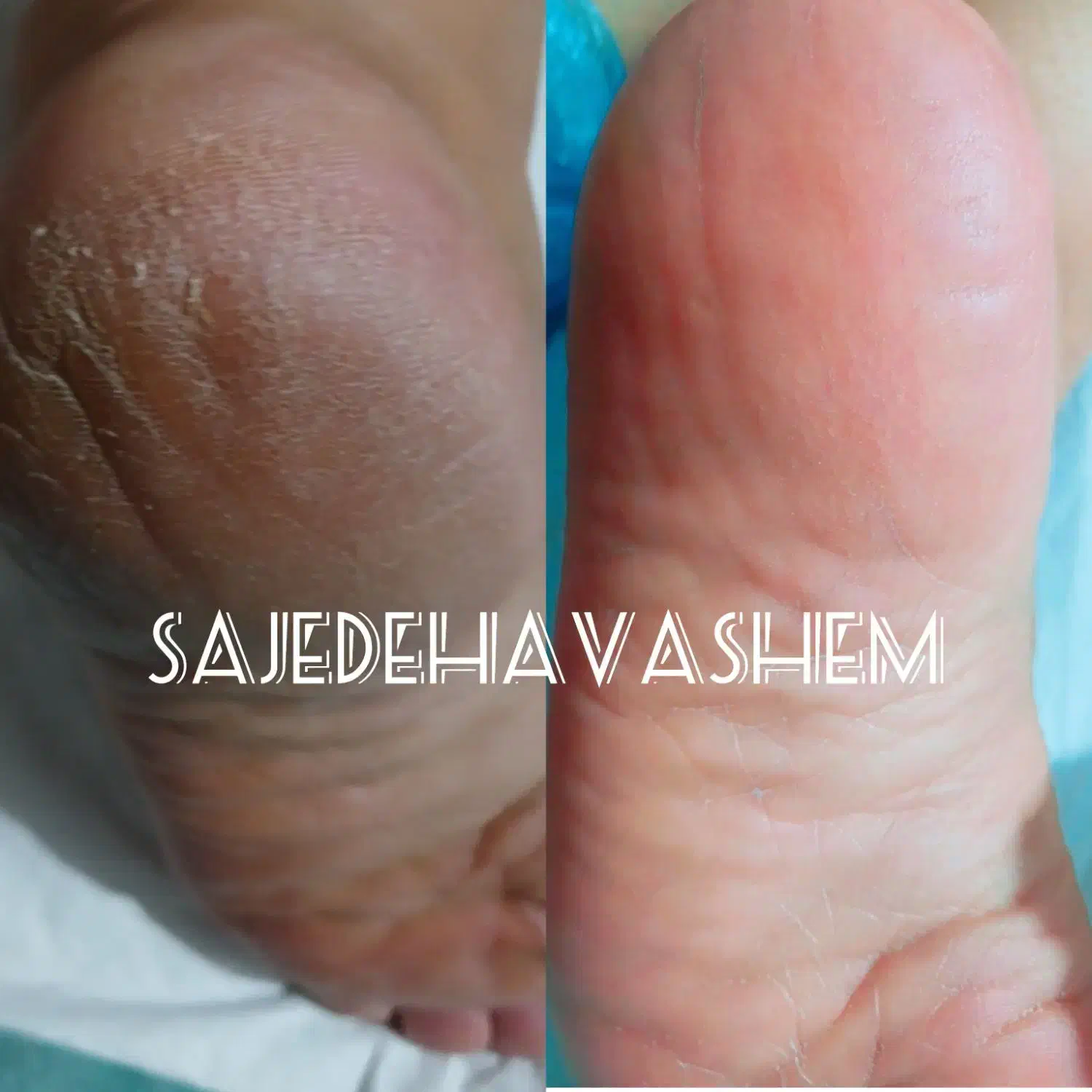 پدیکور پاکسازی|خدمات آرایشگری و زیبایی|اهواز, کوی سعدی|دیوار