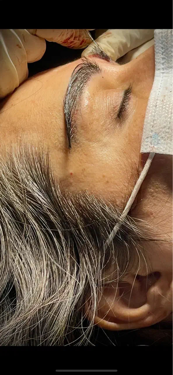 «کاشت ابرو طبیعی در بوشهر تیم پزشکی مجرب|خدمات آرایشگری و زیبایی|بوشهر, |دیوار