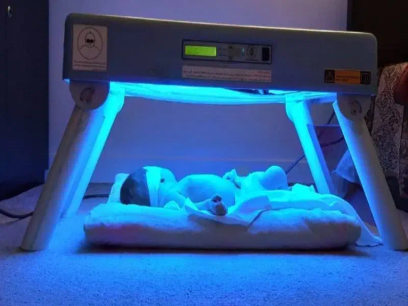 اجازه فتوتراپی نوزادان و دستگاه اکسیژن|پزشکی|زاهدان, |دیوار