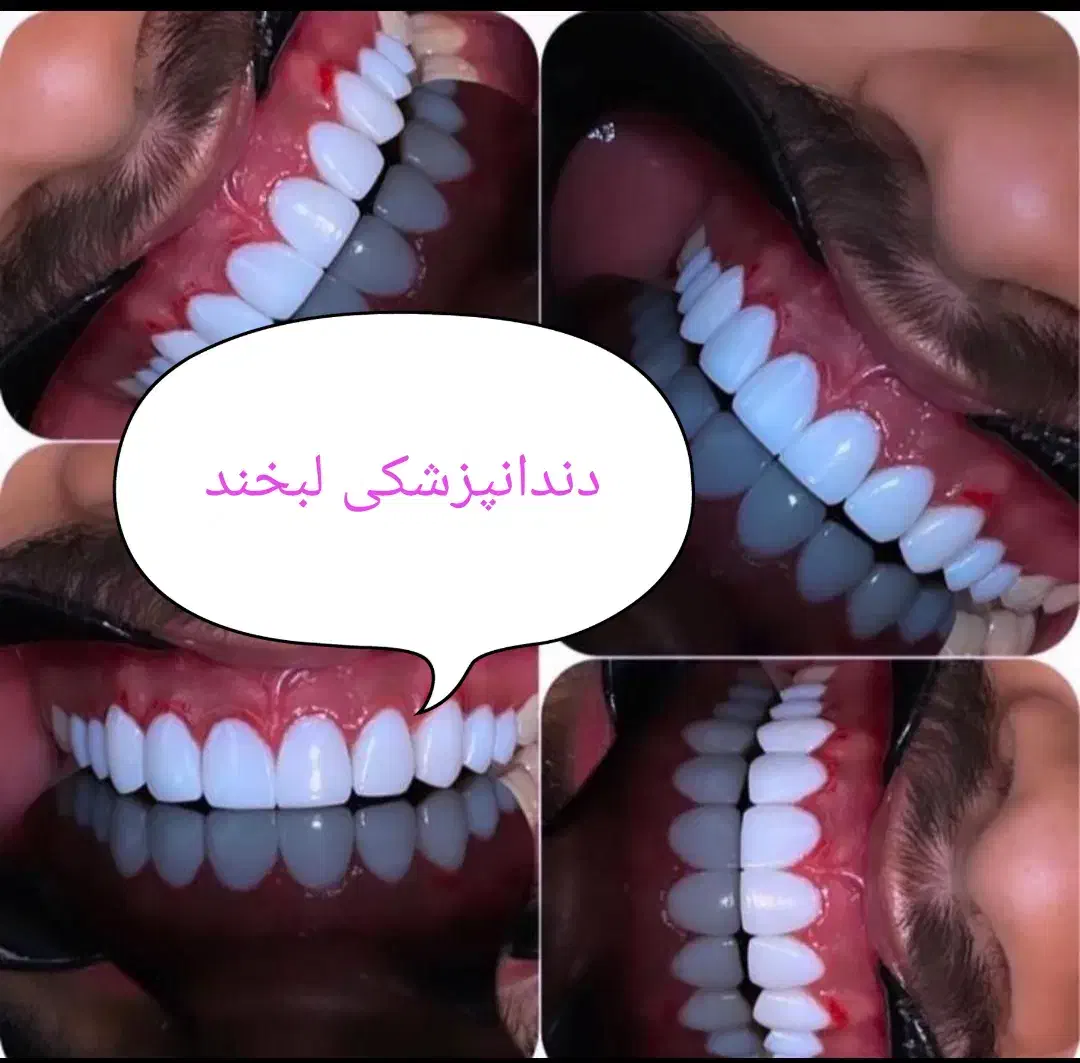 خدمات دندانپزشکی (بانرخ تامین اجتماعی )|خدمات آرایشگری و زیبایی|تبریز, |دیوار