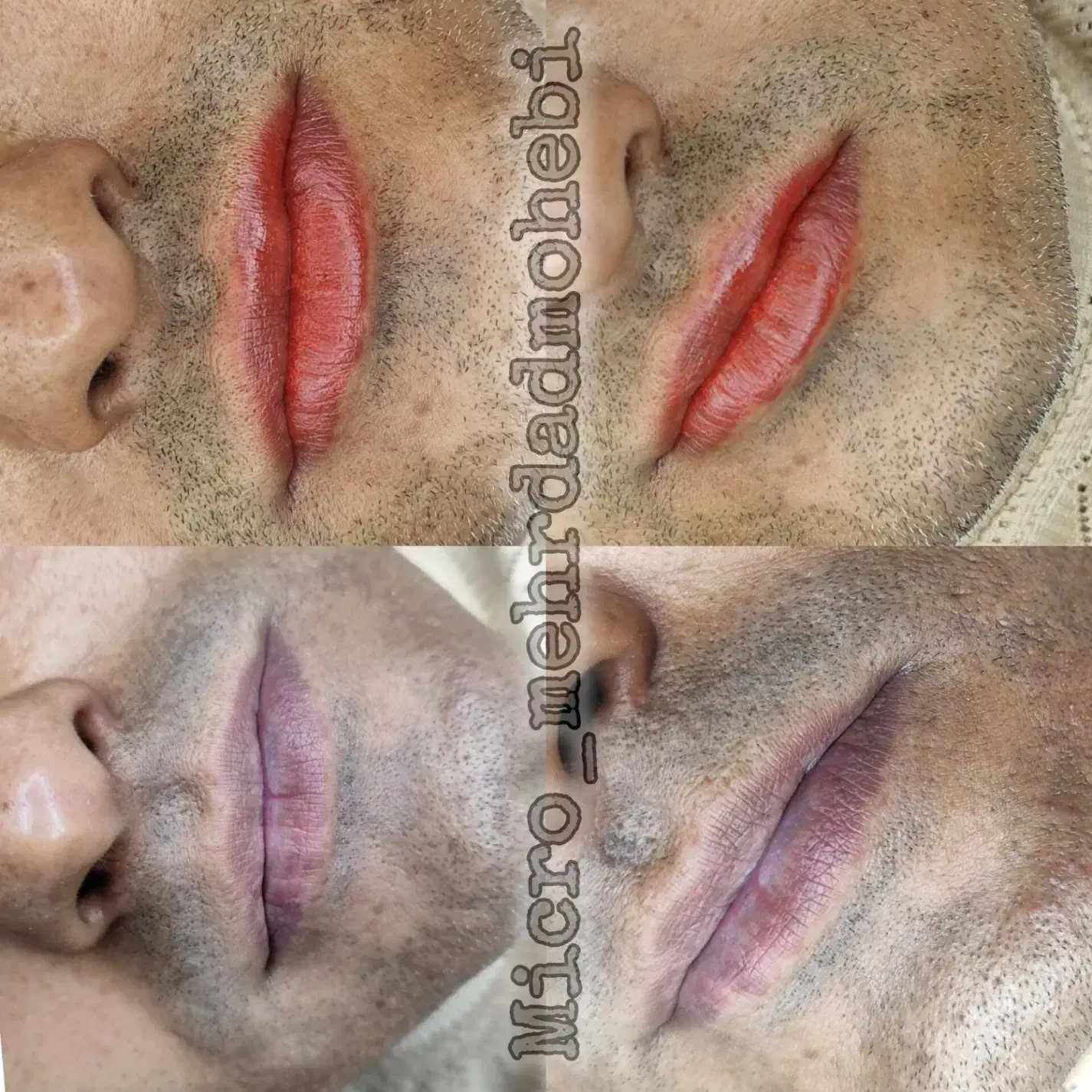 میکروبلیدینگ ابرو/رفع تیرگی لب/اسکالپ سر|خدمات آرایشگری و زیبایی|تهران, نیاوران|دیوار
