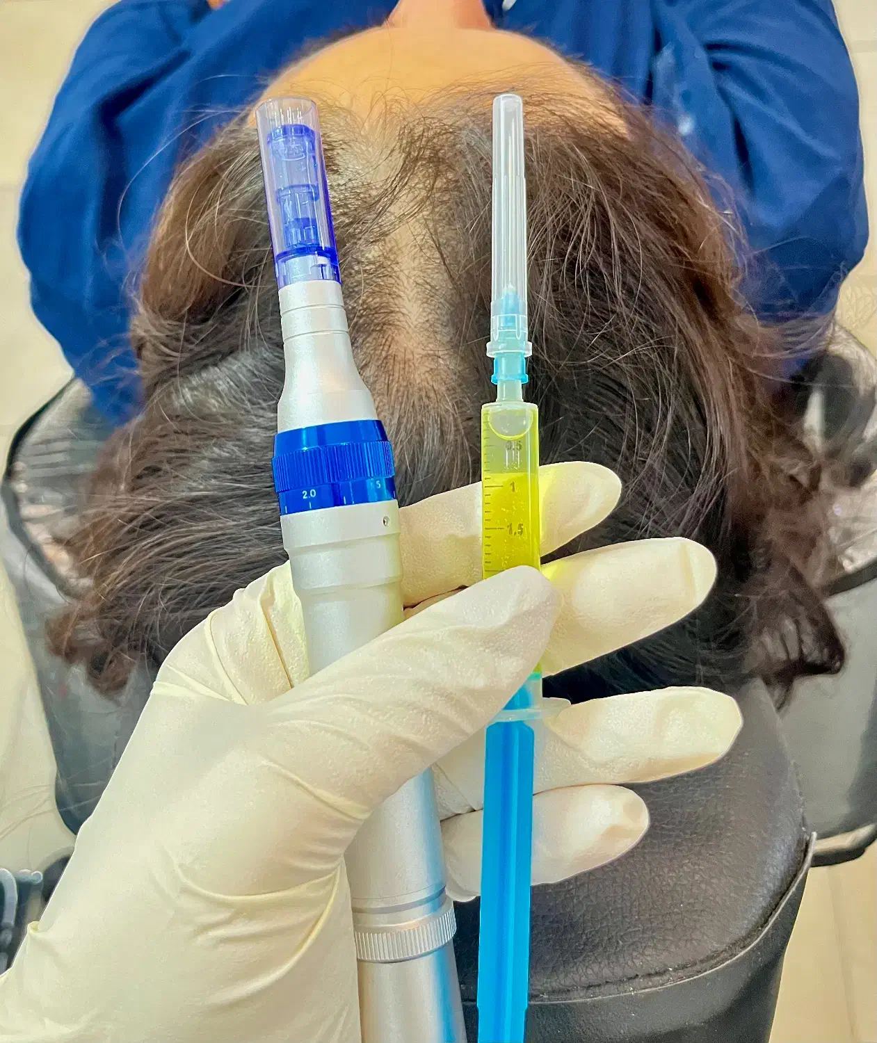 مزوتراپی مو مزونیدلینگ موفقط ۶۵۰ریزش مو رویش مجدد|خدمات آرایشگری و زیبایی|قائم‌شهر, |دیوار