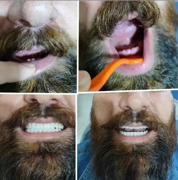 دندان مصنوعی اقساطی|خدمات آرایشگری و زیبایی|اصفهان, عطار نیشابوری|دیوار