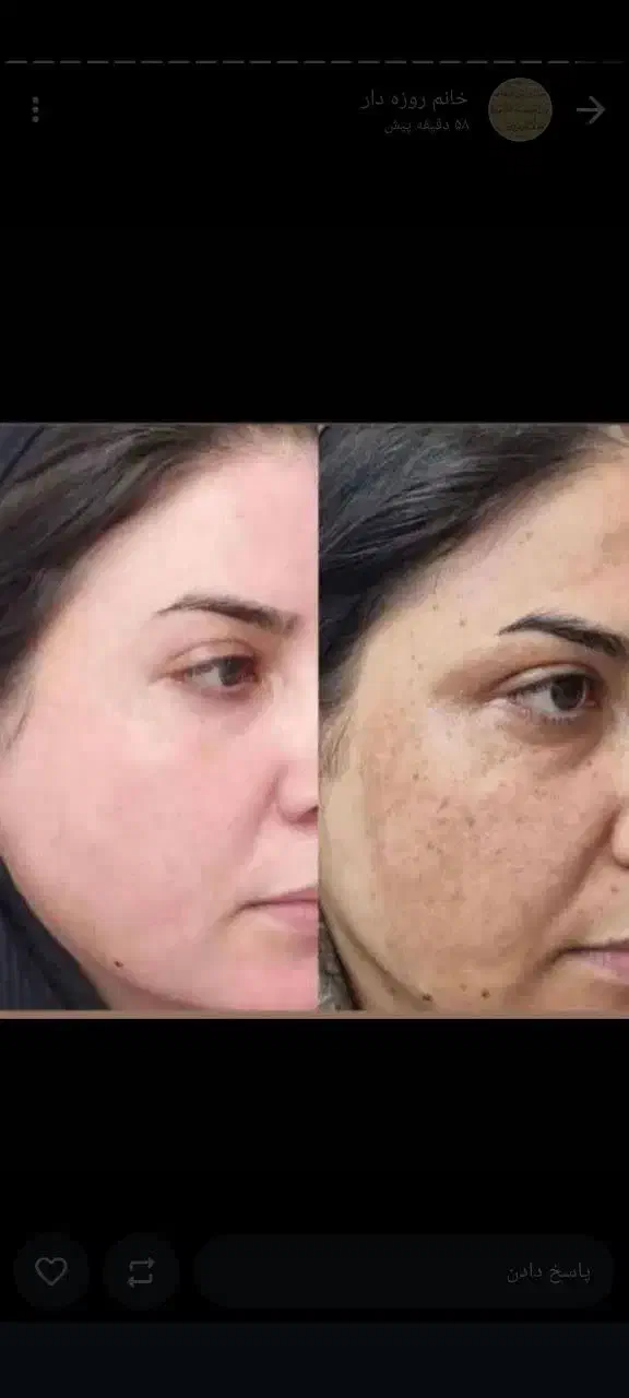 نمایندگی کرم رویال پنج تادهدرجه روشن کنندضدلک قوی|آرایشی، بهداشتی، درمانی|یاسوج, |دیوار