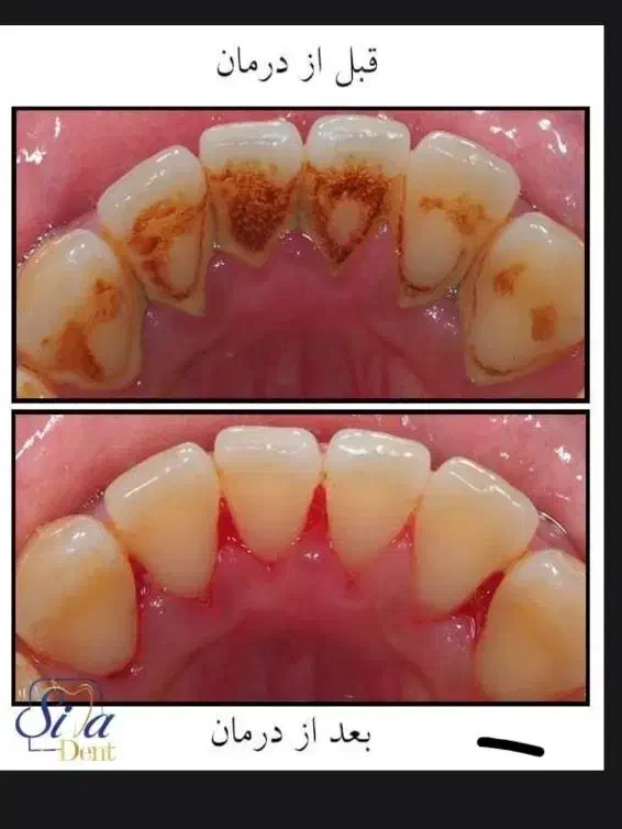 جرمگیری|خدمات آرایشگری و زیبایی|بیرجند, |دیوار