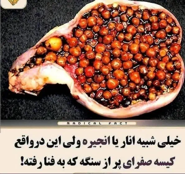 جادوی صفرا|آرایشی، بهداشتی، درمانی|مرند, |دیوار