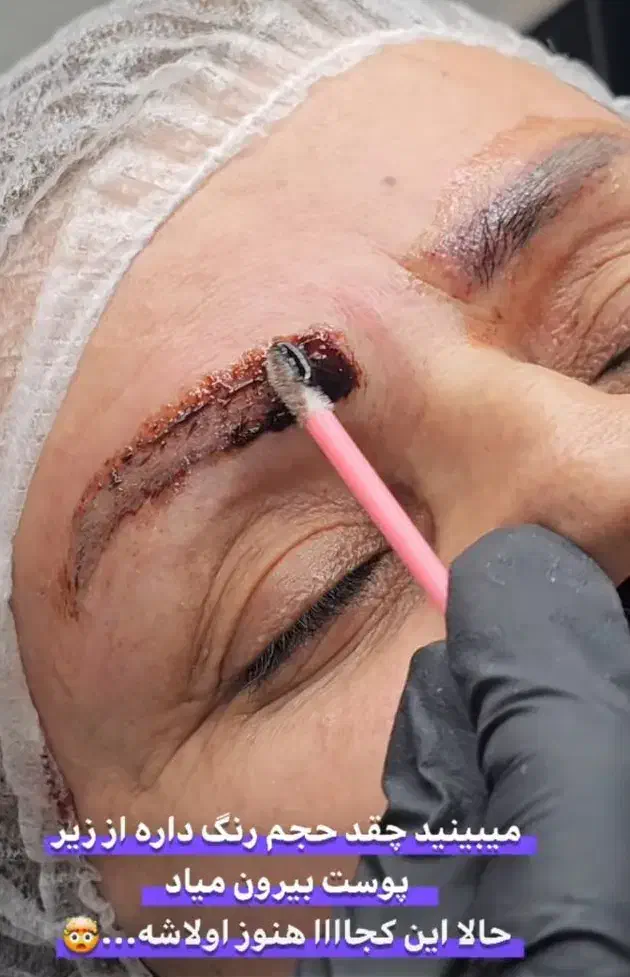 تخفیفات یلدایی ریموو تاتو /آرایش دائم|خدمات آرایشگری و زیبایی|سمنان, |دیوار