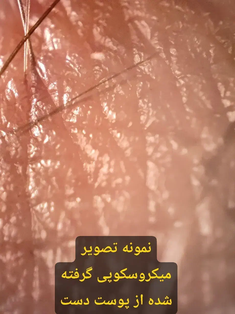 Realme gt3 240W|موبایل|قم, چهار مردان|دیوار