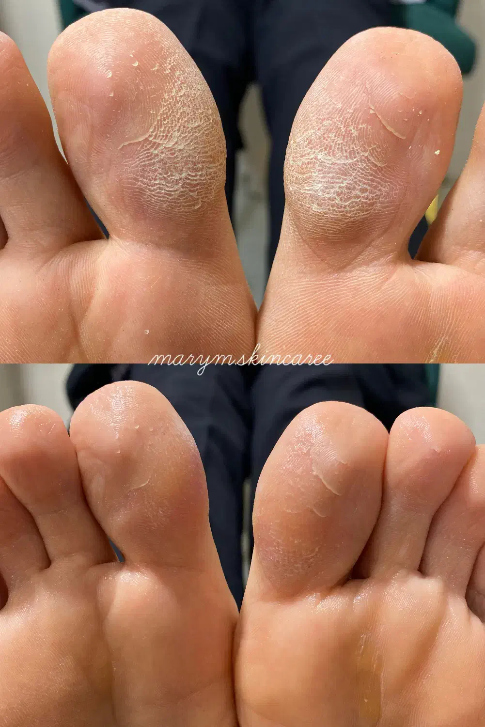 ( اسپا با تخفیف فوق العاده )|خدمات آرایشگری و زیبایی|فیروزآباد (فارس), |دیوار