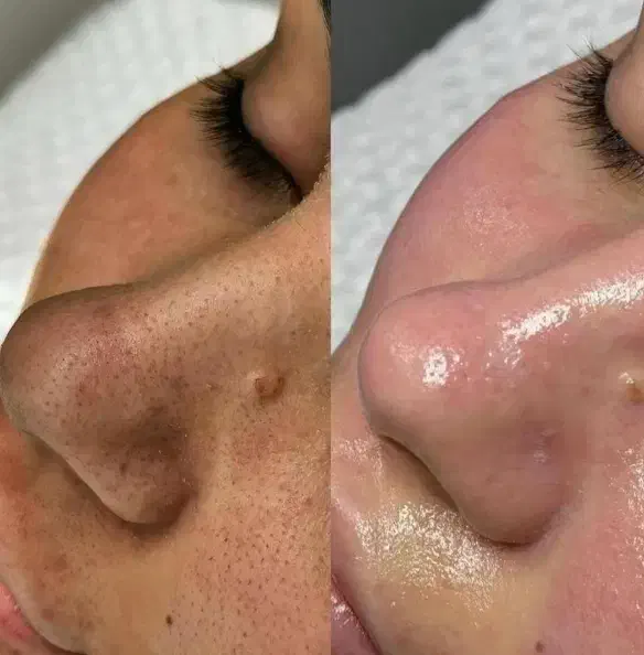 بمب تخفیفات فیشال و خدمات پوستی شروع قیمت از ۱۸۸|خدمات آرایشگری و زیبایی|شیراز, فرگاز|دیوار