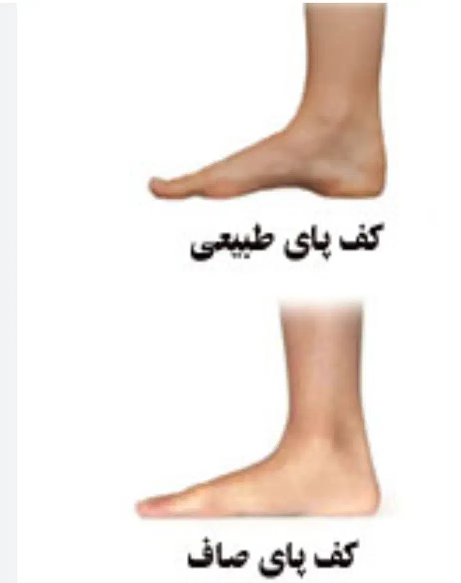 مرکز تخصصی بهبود صافی کف پا و دردهای کف پا|خدمات آرایشگری و زیبایی|بهار, |دیوار