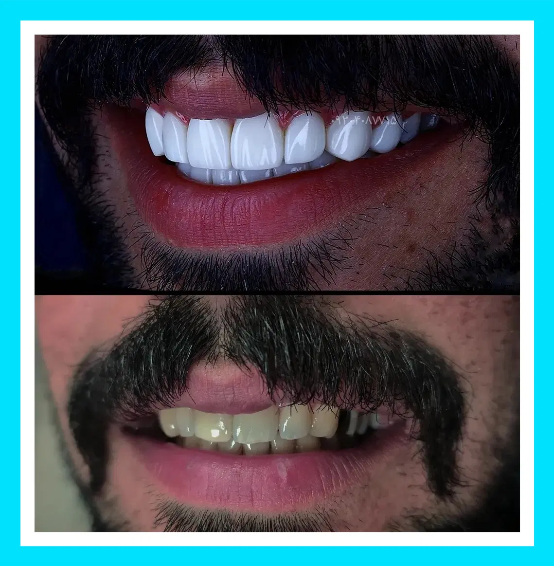 دندانپزشکی/کامپوزیت/ترمیم/عصبکشی ایمپلنت شرق و غرب|خدمات زیبایی و سلامت|تهران, تهرانپارس شرقی|دیوار