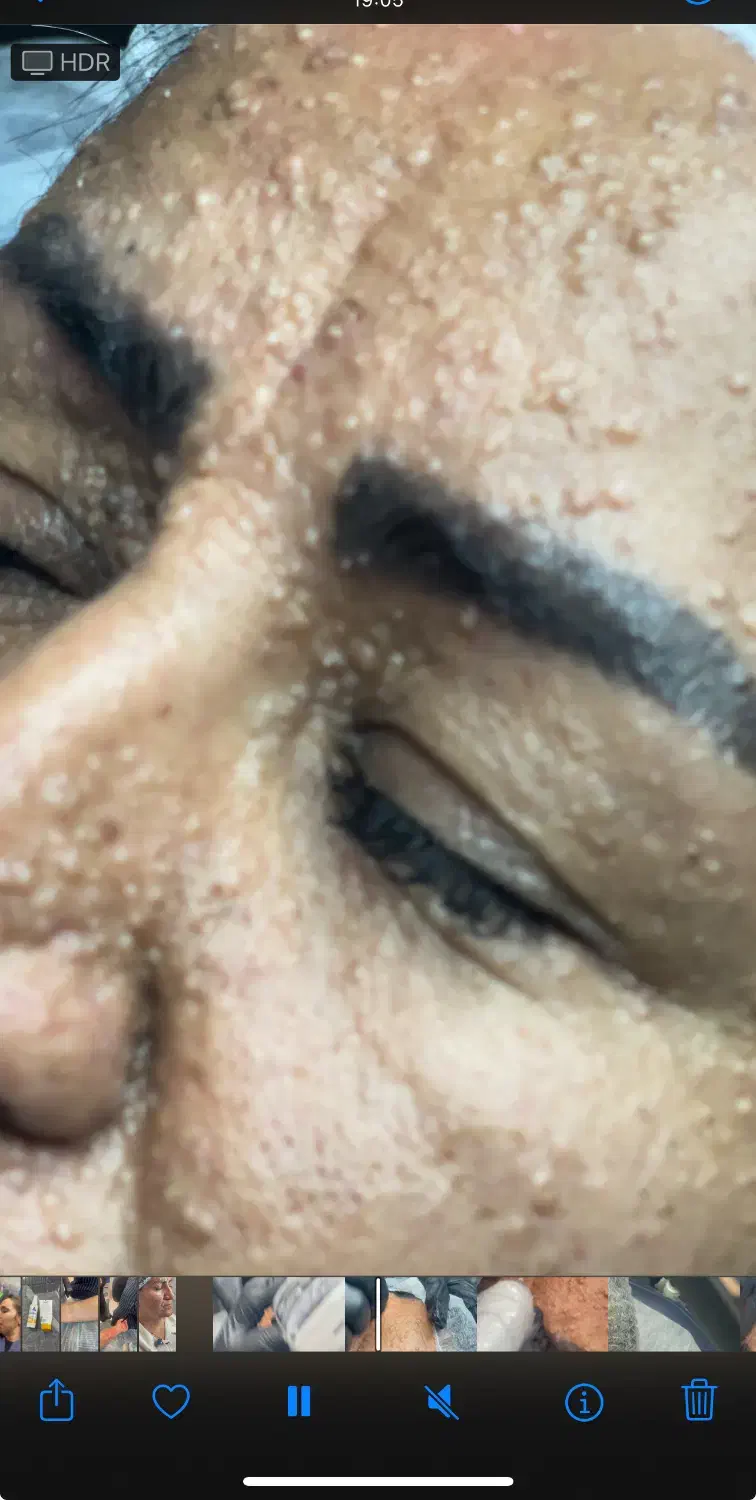ابرسانی عمیق پوست به صورت تزریقی فقط ۱۴۰۰|خدمات آرایشگری و زیبایی|یاسوج, |دیوار