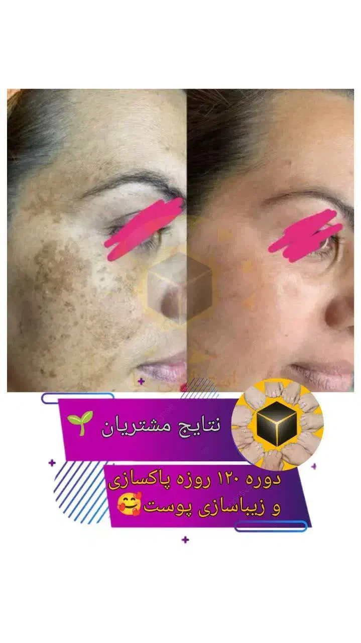 خستگی و سنگینی خداحافظ سبک زندگی سالم سلام|آرایشی، بهداشتی، درمانی|بستان آباد, |دیوار