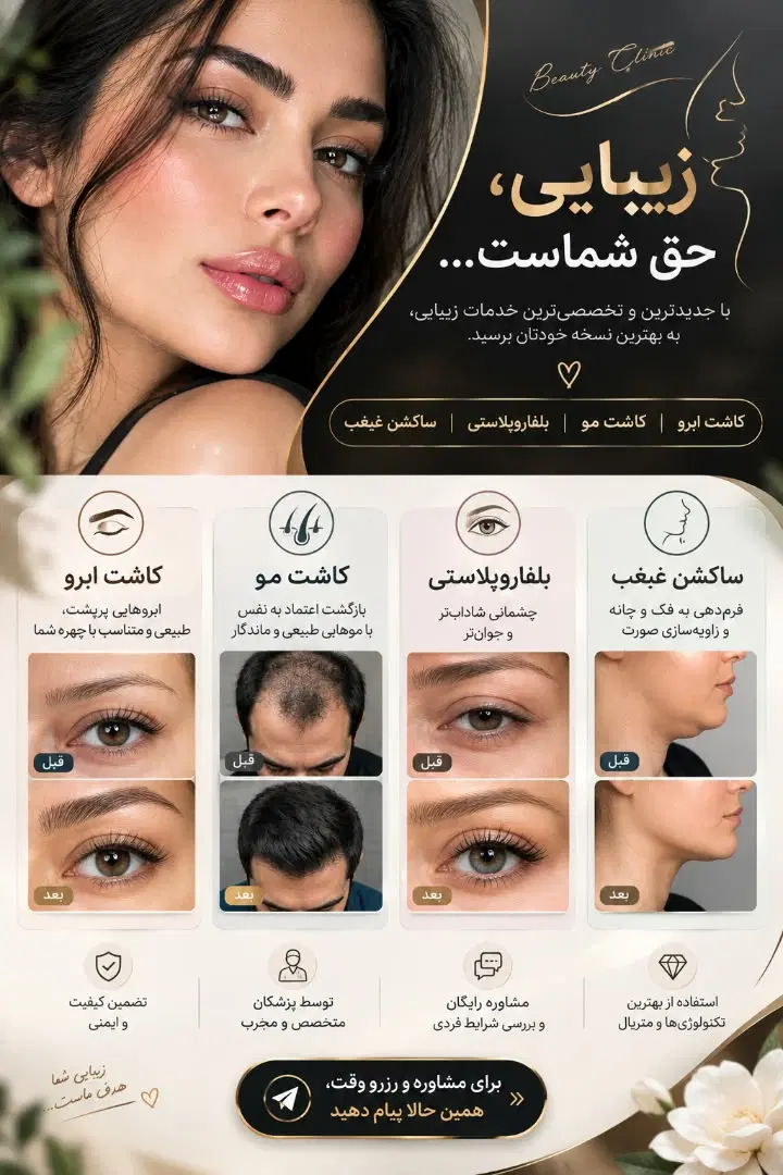 مدل.بلفاروپلاستی.لیپو ساکشن غبغب|خدمات زیبایی و سلامت|تهران, الهیه|دیوار