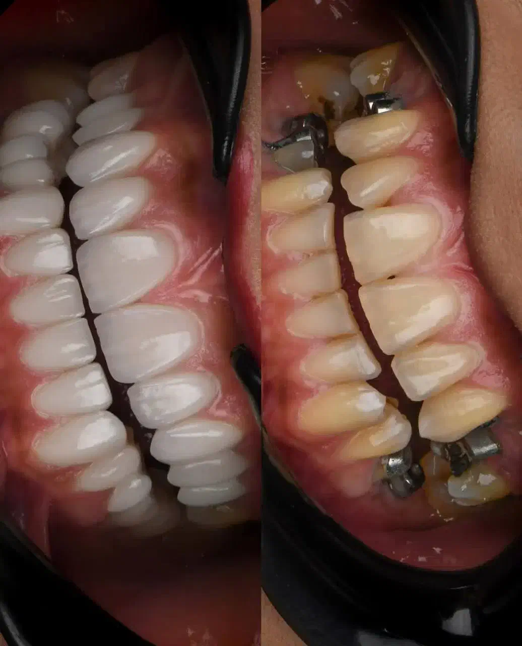 شرایط ویژه جشنواره دندانپزشکی ایمپلنت اوردنچر روکش|خدمات آرایشگری و زیبایی|تبریز, |دیوار